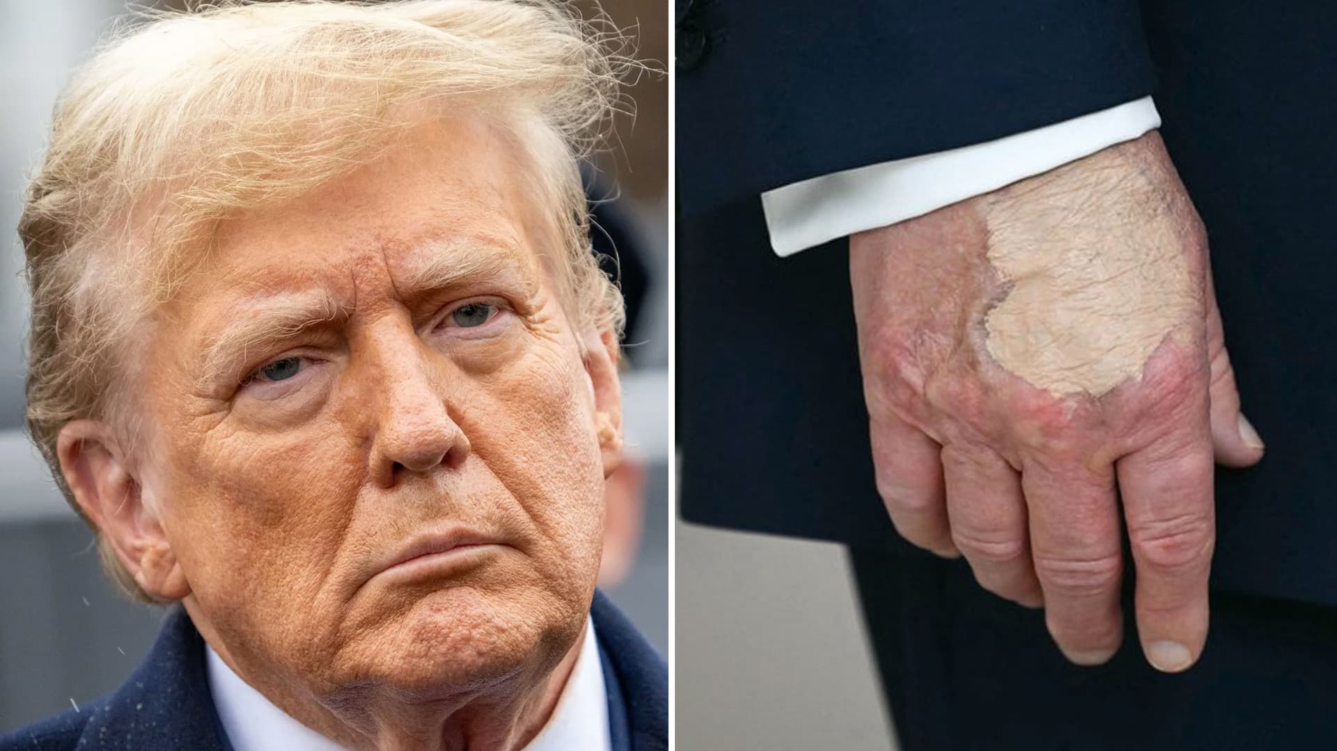 Donald Trump's Hand Makeup and Death Speculation meme template - Donald Trump hand makeup meme