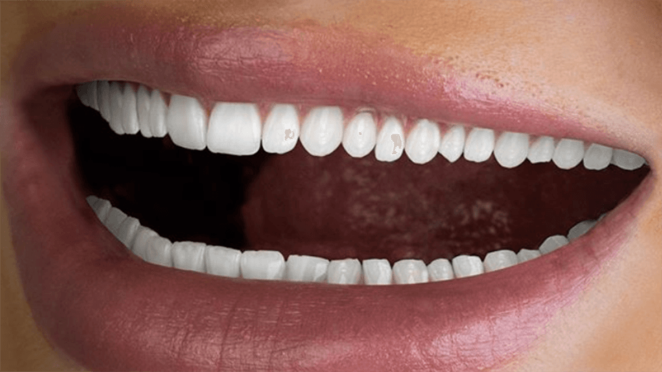 Hi Smile Tiny Teeth Advertisement meme template - Hi Smile Tiny Teeth