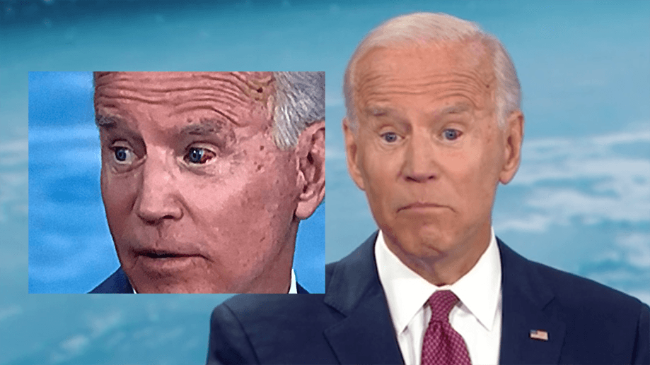Joe Biden's Bleeding Eye meme template - Joe Biden Bleeding Eye