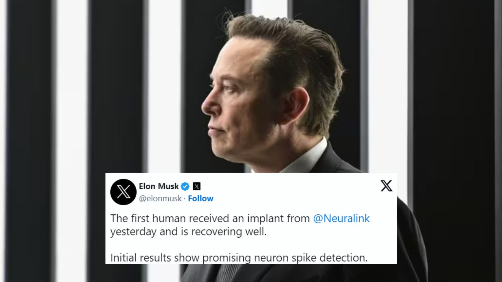 Neuralink Brain Chip Implant meme template - Neuralink