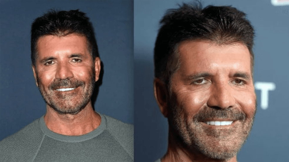 Simon Cowell's Face meme template - Simon Cowell Face