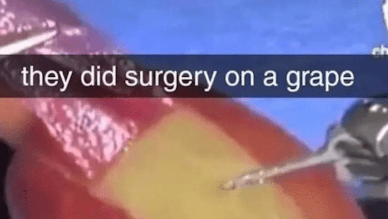 They Did Surgery On a Grape meme template - They Did Surgery On a Grape