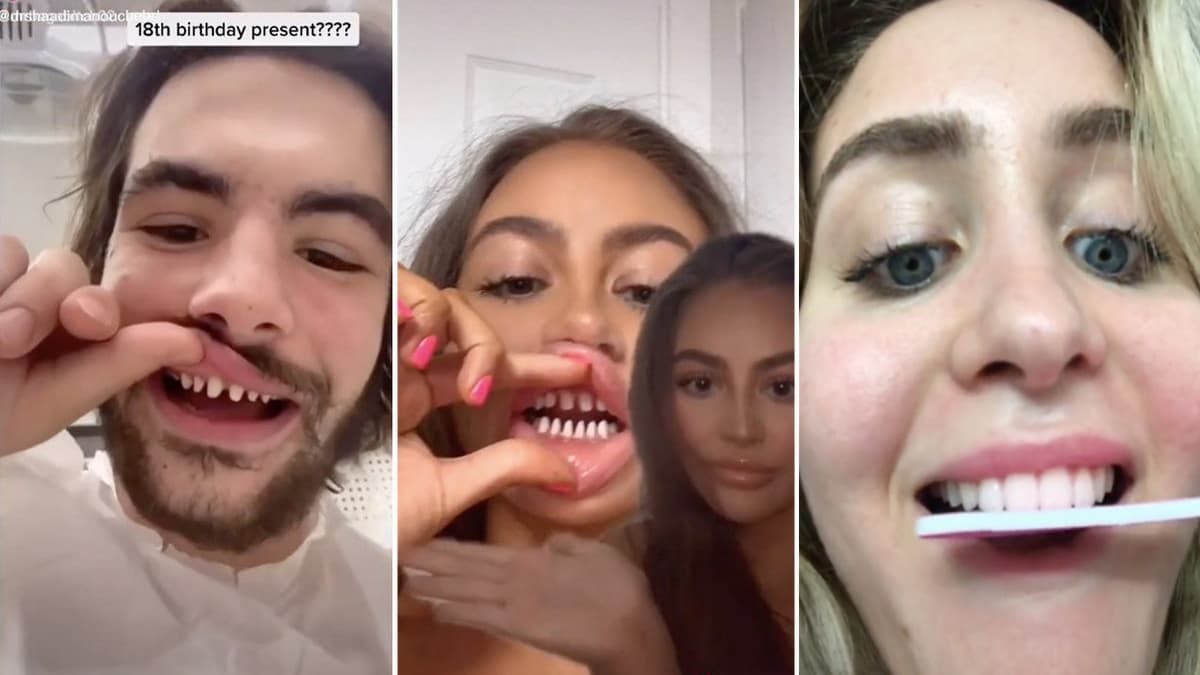 TikTok Teeth Shaving meme template - TikTok Teeth Shaving